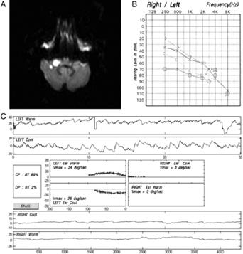 http://stroke.ahajournals.org/content/40/12/3745/F1.medium.gif