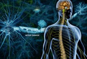 http://img.webmd.com/dtmcms/live/webmd/consumer_assets/site_images/articles/health_tools/ms_overview_slideshow/webmd_rm_photo_of_nerve_damage.jpg