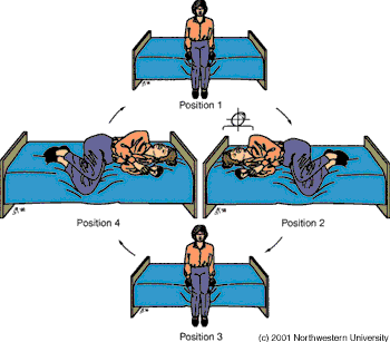 Brandt-Daroff Esercizi per BPPV