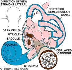 http://www.dizziness-and-balance.com/images/otoconia.gif