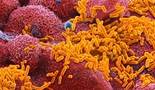 http://www.nhs.uk/Conditions/hib/PublishingImages/B220877-Haemophilus_influenzae_bacteria_342x198.jpg