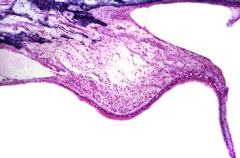 http://otopathologynetwork.org/attachmentview!/149804/cms_attachments/1/182.jpg