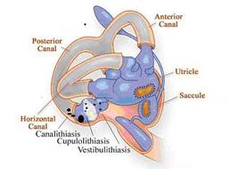 http://www.tchain.com/otoneurology/images/bppv-mech.jpg