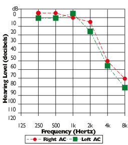 http://www.ihsinfo.org/IhsV2/hearing_professional/2003/060_November-December/Images/CHART%201.gif