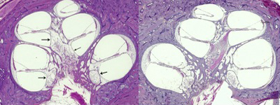 http://www.hei.org/research/temporalbone/files/2012/05/presbfig14c.jpg