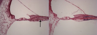 http://www.hei.org/research/temporalbone/files/2012/05/presbfig16c.jpg