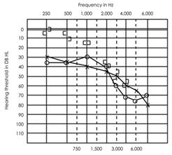 http://synapse.koreamed.org/ArticleImage/0038KJORL-HN/kjorl-hns-54-784-g003-l.jpg