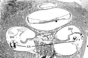 http://www.mussenhealth.us/cochlear-implants/images/1872_12_24.jpg