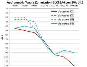 http://www.vincenzopiazza.it/immagini/audiometria%20tonale.jpg