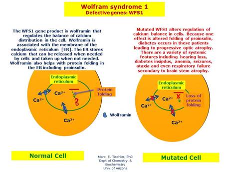 http://disorders.eyes.arizona.edu/sites/disorders.eyes.arizona.edu/files/disorder_images/wolfram_syndrome_1.jpg