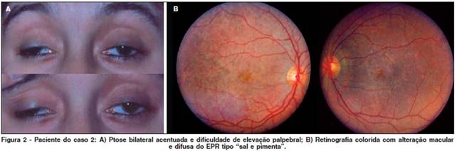 http://www.scielo.br/img/revistas/abo/v72n1/a19fig02.jpg