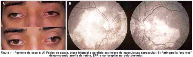 http://www.scielo.br/img/revistas/abo/v72n1/a19fig01.jpg