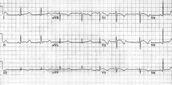 http://img.medscape.com/pi/emed/ckb/cardiology/150072-157826-1861.jpg