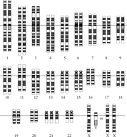 http://upload.wikimedia.org/wikipedia/commons/thumb/1/11/Down_Syndrome_Karyotype.png/1024px-Down_Syndrome_Karyotype.png