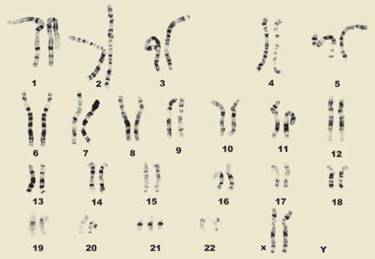 http://www.ndss.org/PageFiles/2588/Trisomy%2021%20Karyotype%20Female%20-%20Copy.jpg