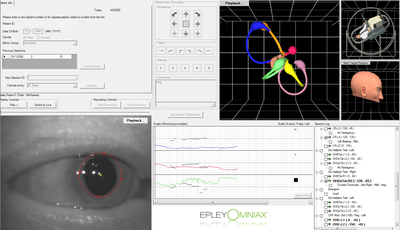 Epley software Omniax