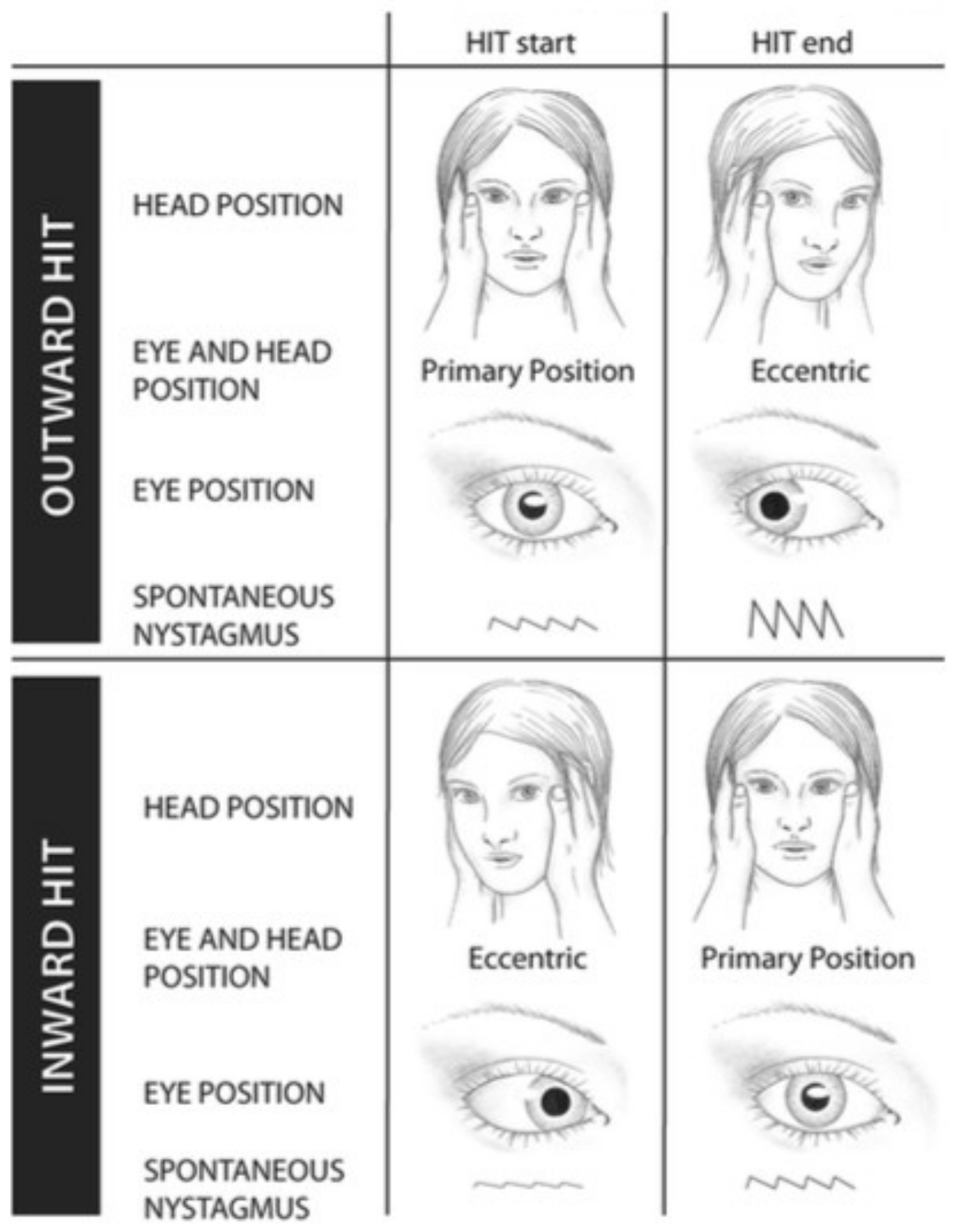 Il video head impulse test (vHIT)