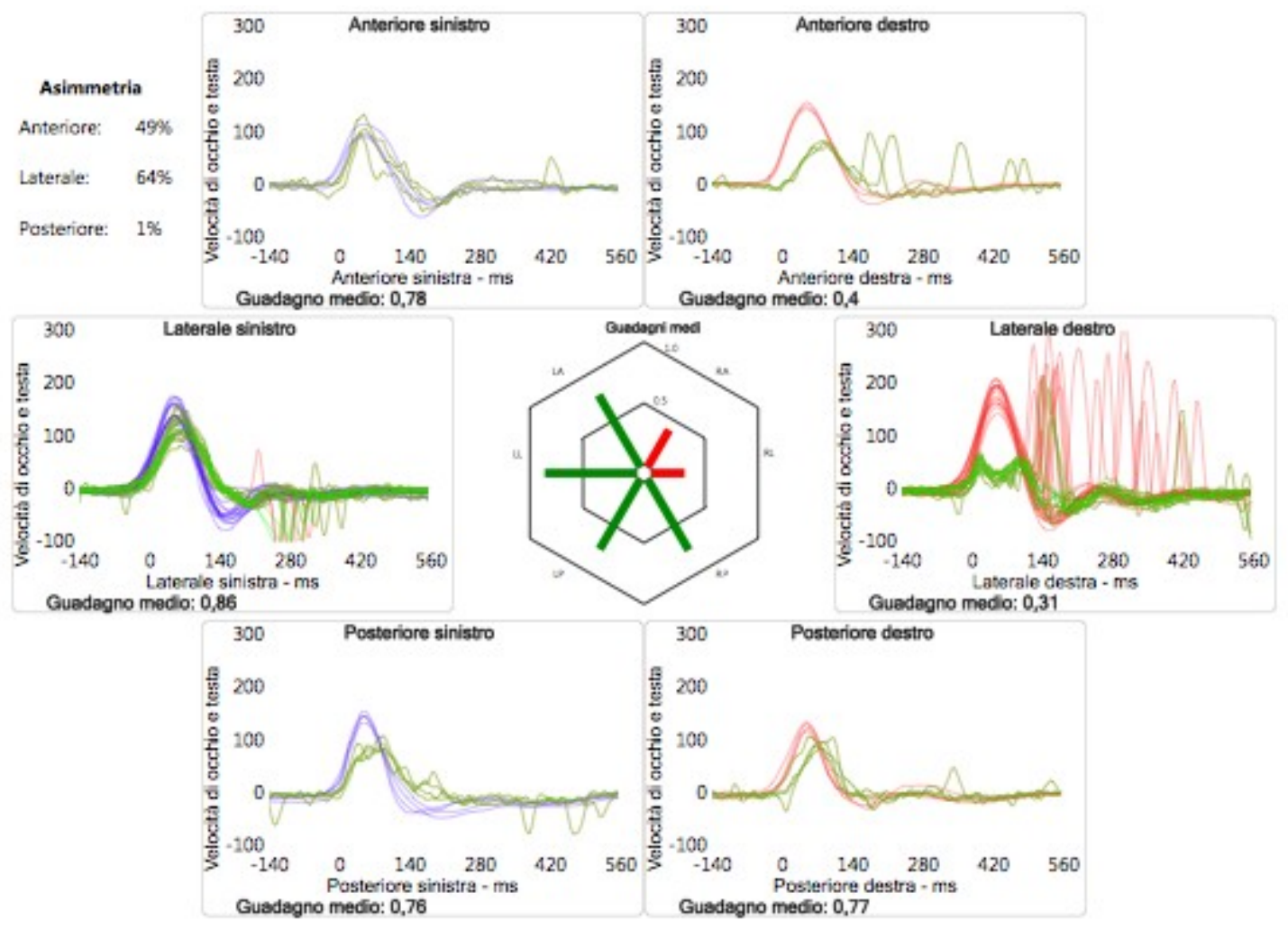 Il video head impulse test (vHIT)