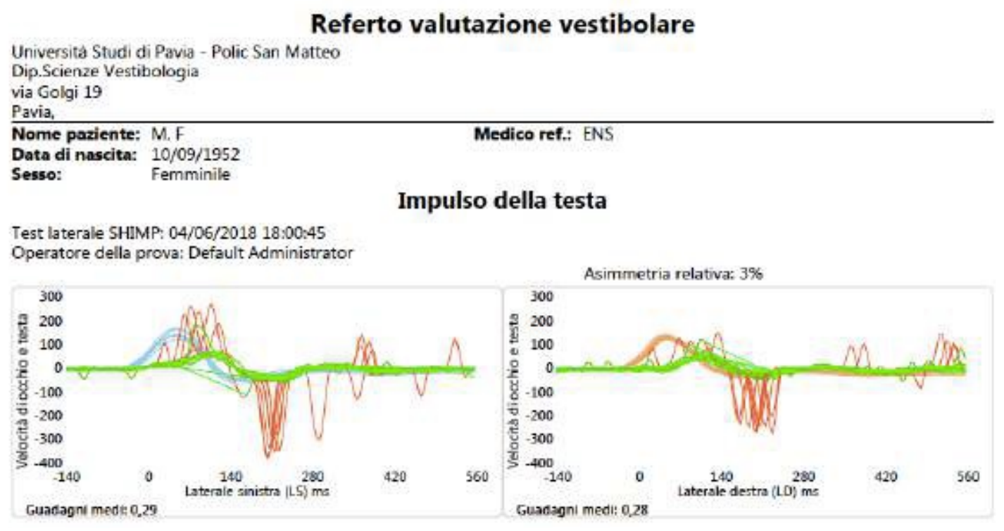 Il video head impulse test (vHIT)