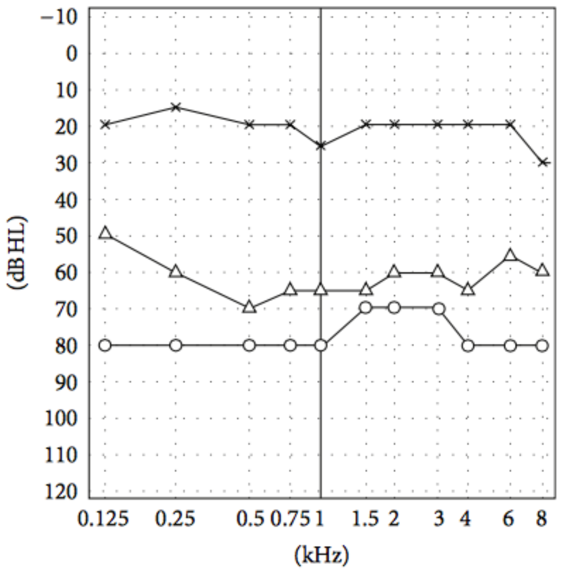 Il video head impulse test (vHIT)