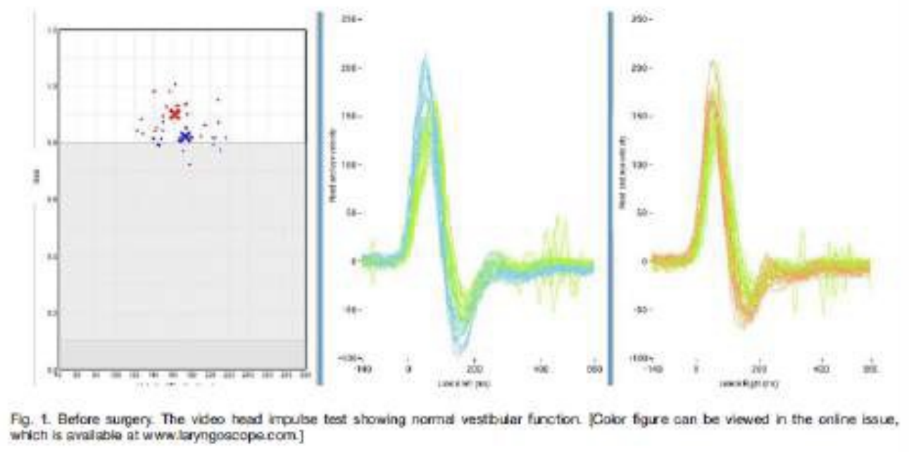 Il video head impulse test (vHIT)